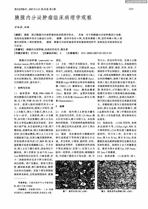 胰腺内分泌肿瘤临床病理学观察
