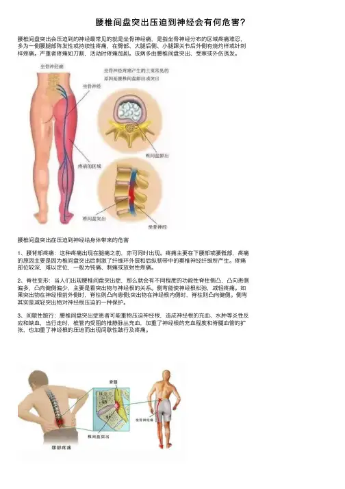 腰椎间盘突出压迫到神经会有何危害？