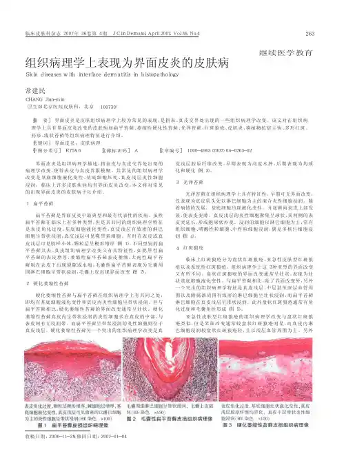 组织病理学上表现为界面皮炎的皮肤病