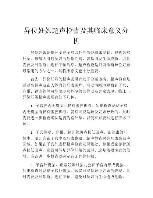 异位妊娠超声检查及其临床意义分析