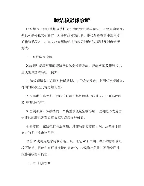 肺结核影像诊断