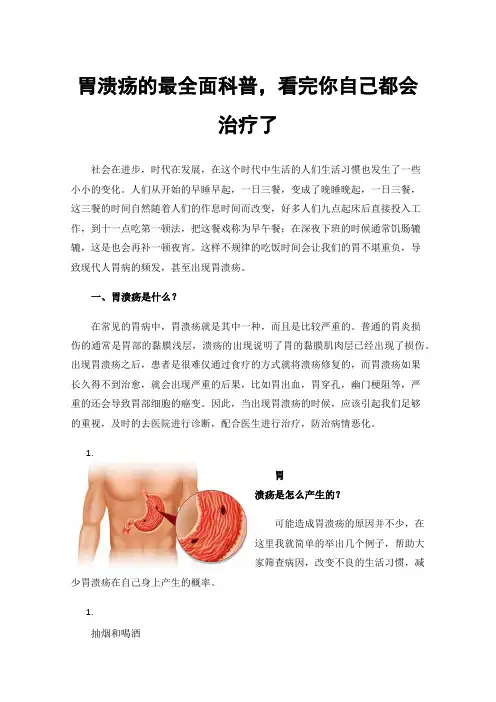 胃溃疡的最全面科普，看完你自己都会治疗了