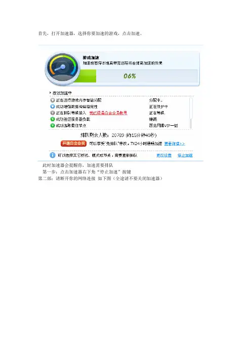 加速器无需排队详细教程!