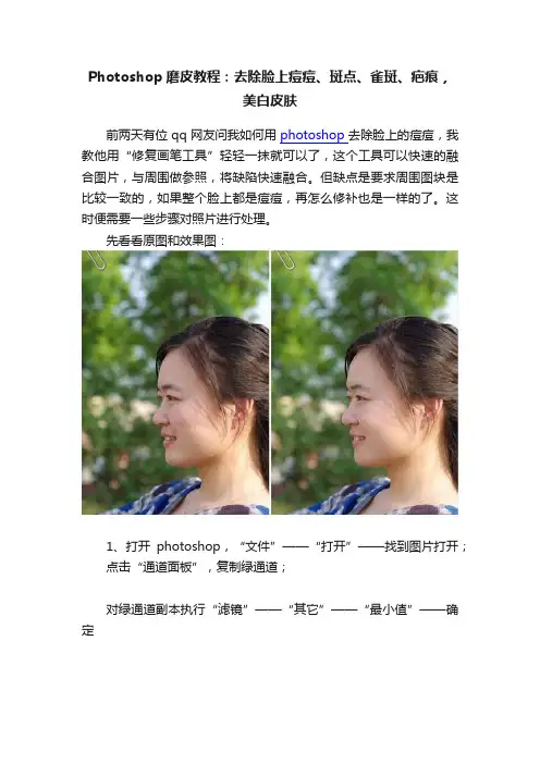 Photoshop磨皮教程：去除脸上痘痘、斑点、雀斑、疤痕，美白皮肤