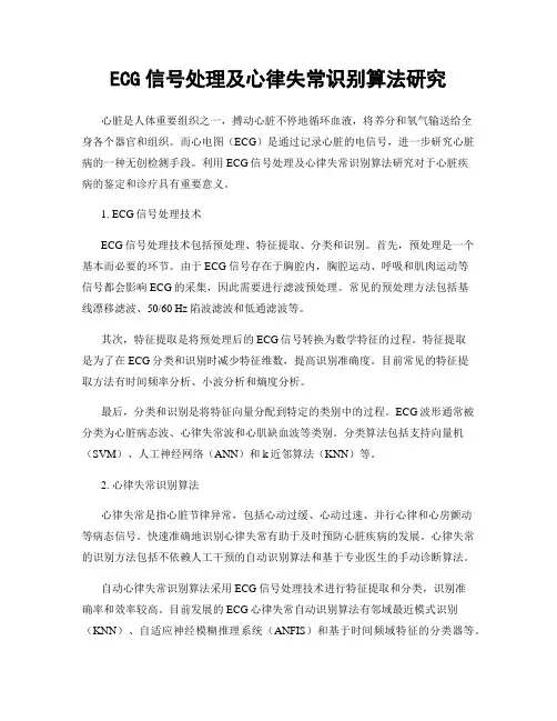 ECG信号处理及心律失常识别算法研究