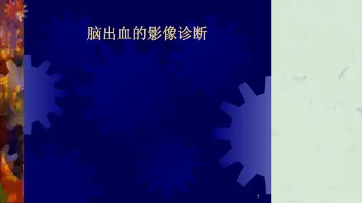 脑出血影像学课件
