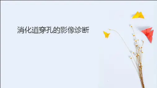 消化道穿孔的影像诊断