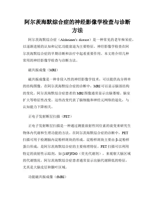 阿尔茨海默综合症的神经影像学检查与诊断方法