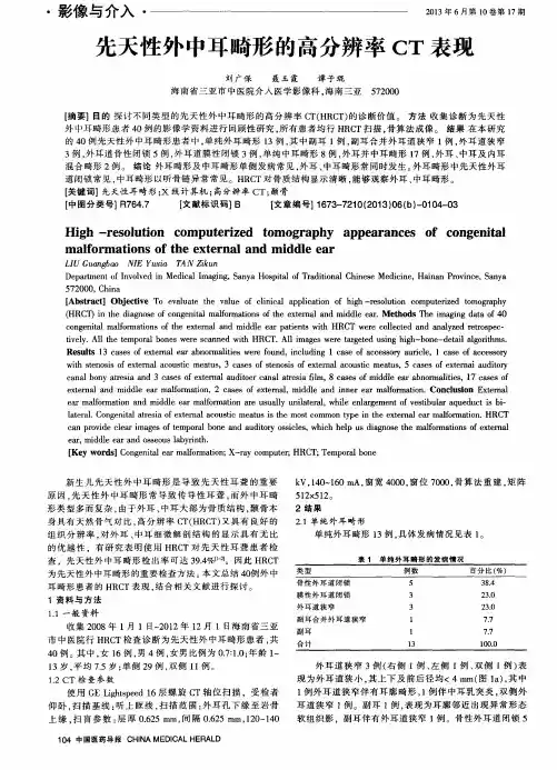 先天性外中耳畸形的高分辨率CT表现