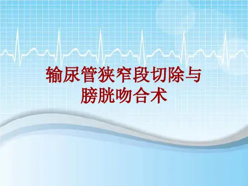 手术讲解模板：输尿管狭窄段切除与膀胱吻合术