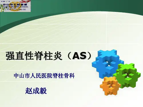 强直性脊柱炎