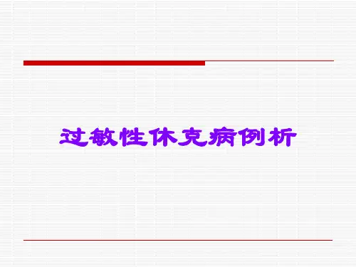 过敏性休克病例析