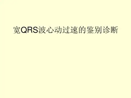 宽QRS波心动过速的鉴别诊断