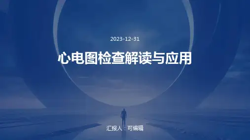心电图检查解读与应用