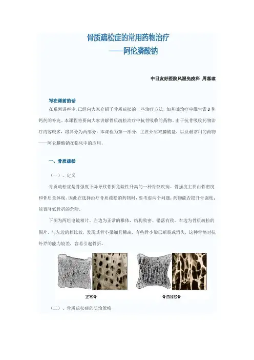 阿伦磷酸钠Microsoft Word 文档