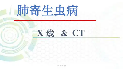 肺寄生虫病X线ppt课件