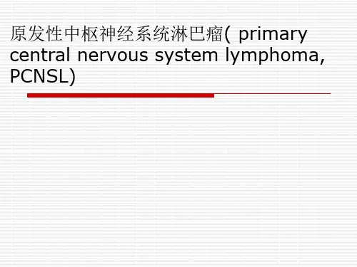 中枢淋巴瘤CNSL