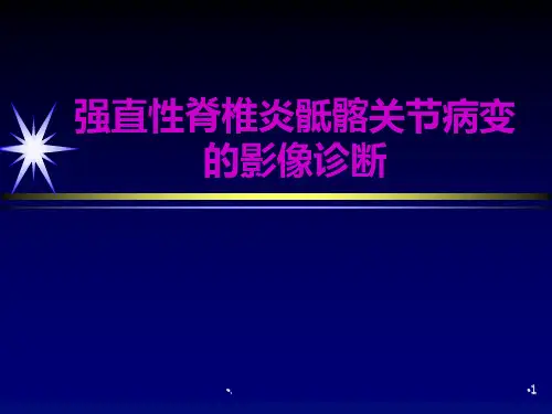 强直性脊椎炎骶髂关节病变的影像诊断ppt课件