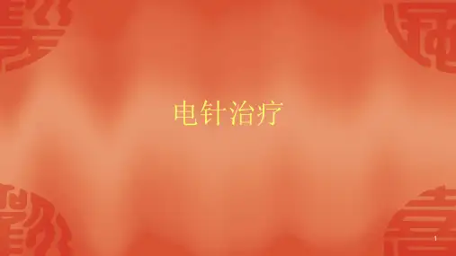 电针治疗ppt课件