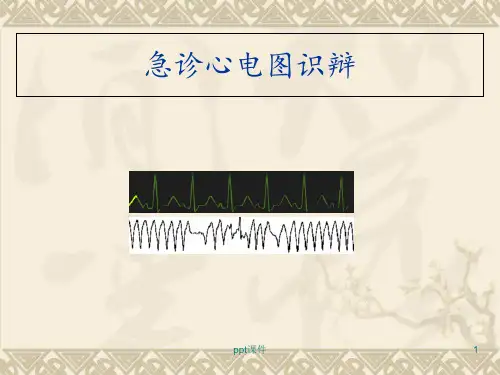 急诊心电图识辩  ppt课件