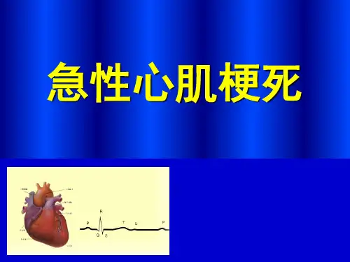 急性心肌梗死查房课件
