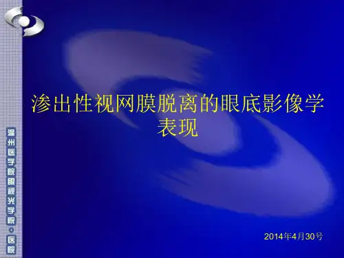 渗出性视网膜脱离的眼底影像学表现
