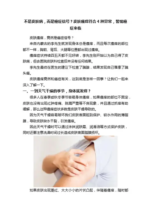 不是皮肤病，而是癌症信号？皮肤瘙痒符合4种异常，警惕癌症来临