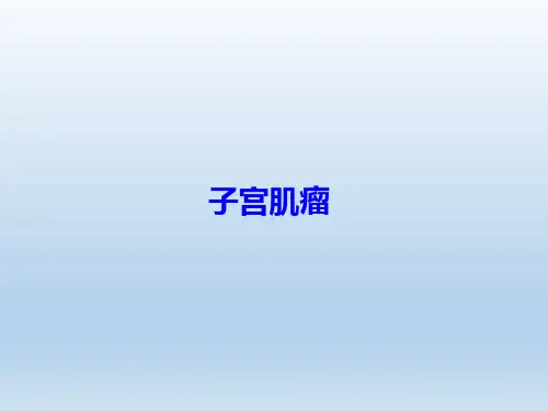子宫肌瘤课