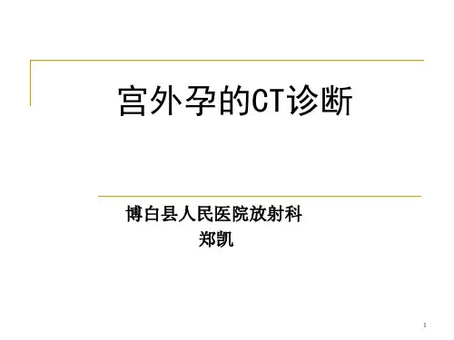 宫外孕CT诊断