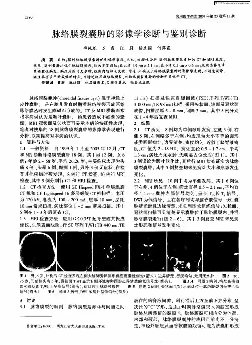 脉络膜裂囊肿的影像学诊断与鉴别诊断