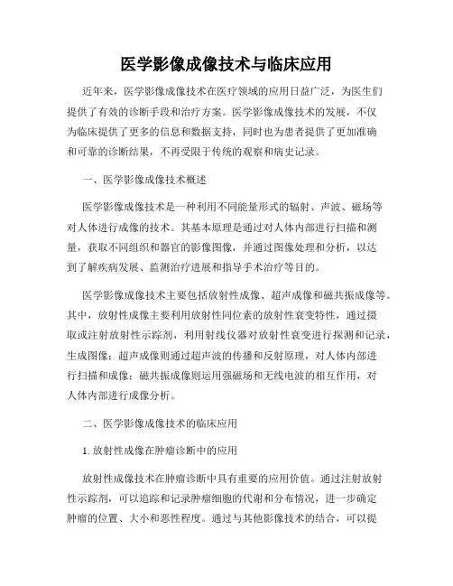 医学影像成像技术与临床应用