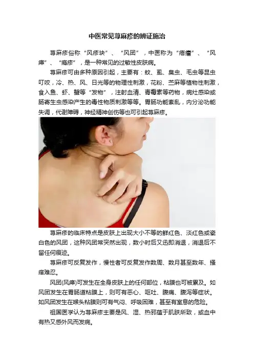 中医常见荨麻疹的辨证施治