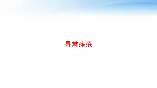 寻常痤疮 ppt课件