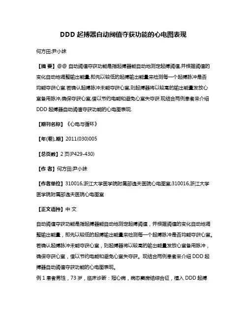DDD起搏器自动阈值夺获功能的心电图表现