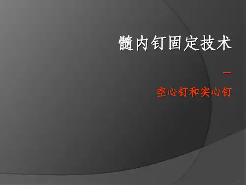 AO髓内钉固定技术
