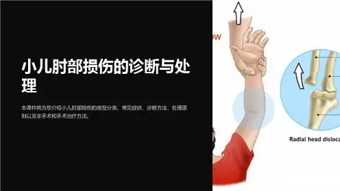 小儿肘部损伤的诊断与处理PPT课件