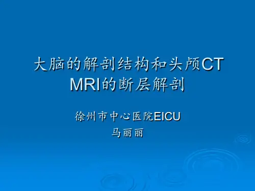 大脑的解剖结构与头颅MRI的影像分析报告