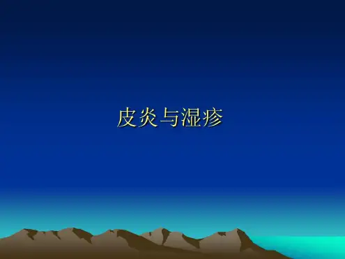 皮炎和湿疹的鉴别-2022年学习资料;