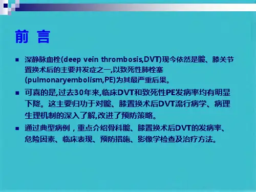 深静脉血栓DVT预防(共43张PPT)