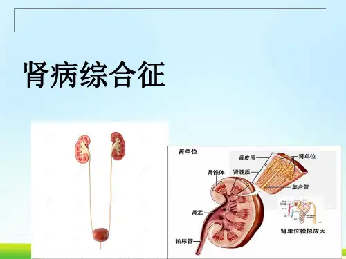 肾病综合征PPT课件