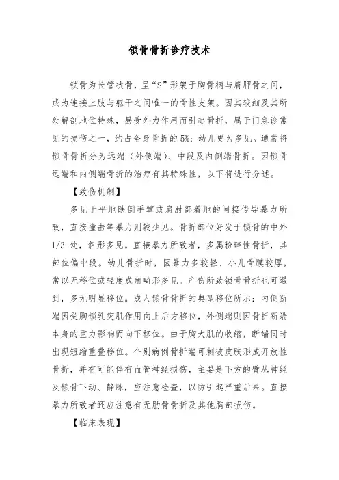 锁骨骨折诊疗技术