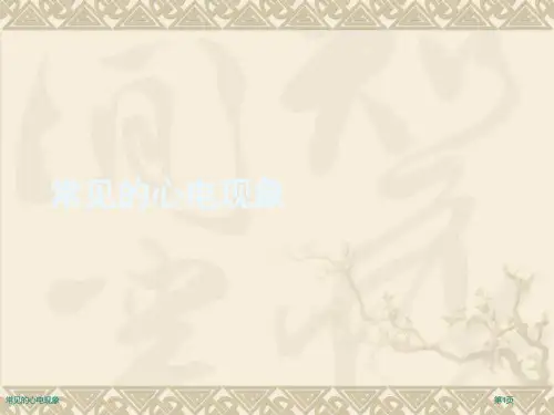常见的心电现象