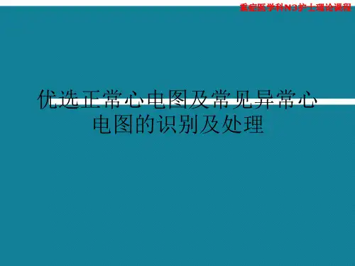 优选正常心电图及常见异常心电图的识别及处理