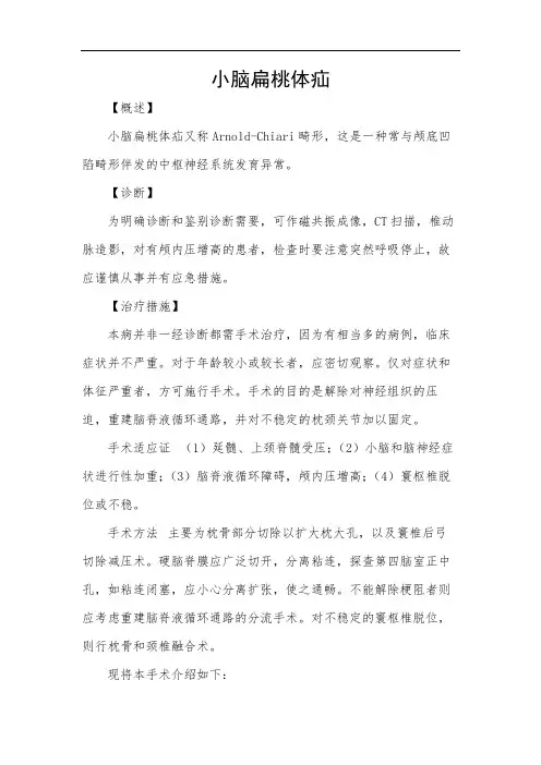 小脑扁桃体疝