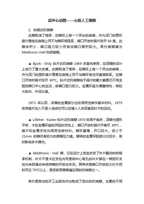 超声心动图——心脏人工瓣膜