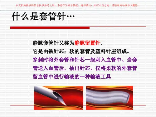 静脉留置针应用及封管培训课件