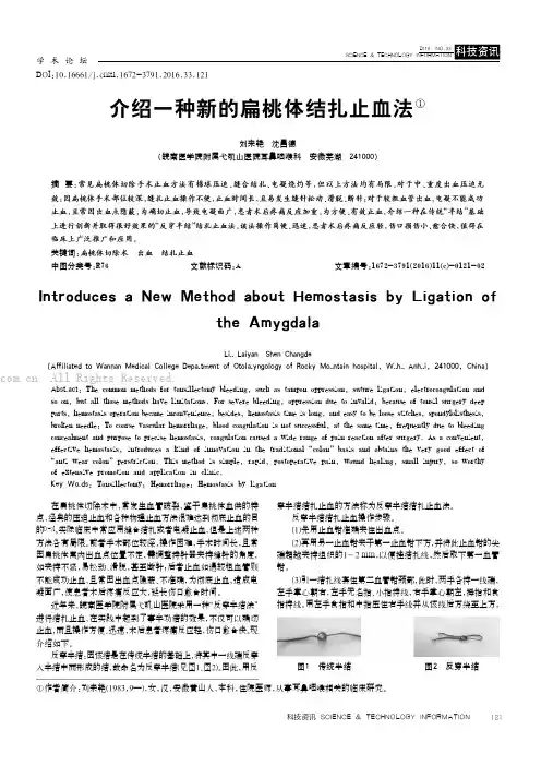 介绍一种新的扁桃体结扎止血法