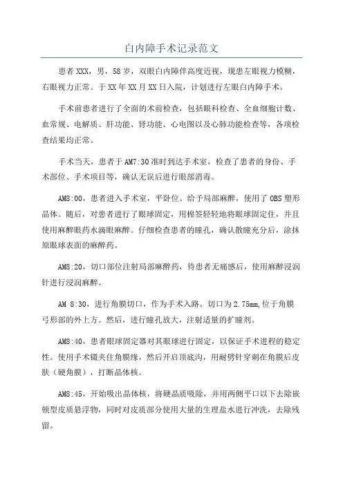 白内障手术记录范文