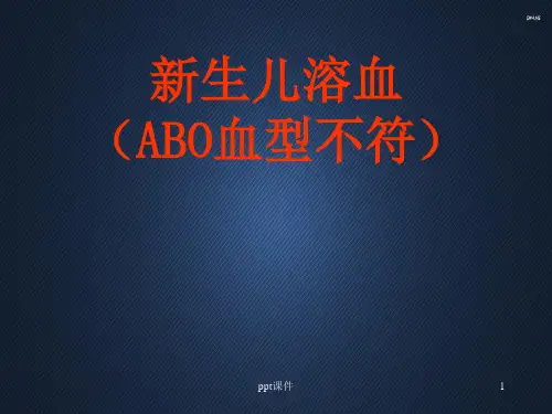 儿科护理查房--新生儿溶血  ppt课件