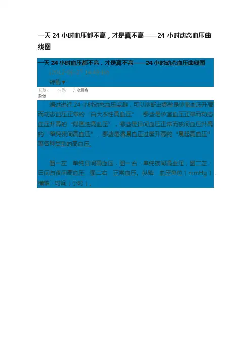 一天24小时血压都不高，才是真不高——24小时动态血压曲线图